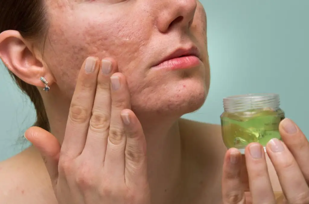 combattre acne huile jojoba